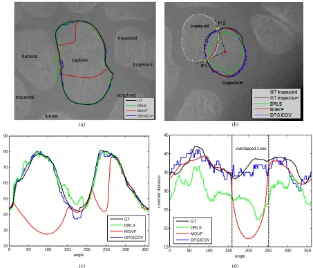 Fig.  7   CROI with corresponding segmentation results for all 7 carpal bones using (a) DRLS (b) MGVF and (c) DP-GICOV