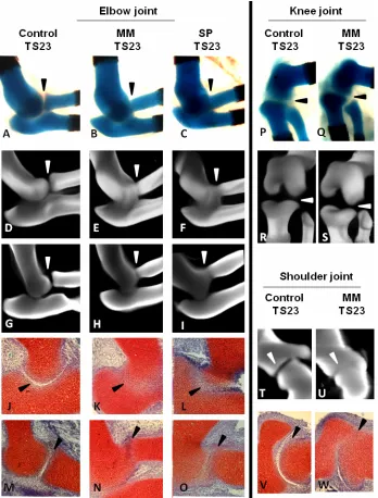Figure 4.  Joint line reduction in limbs devoid of skeletal muscle in Myf5scapula-humerus joint line of the shoulder is reduced, shown in sections of 3D reconstructions Alcian Blue stained tissue (T-U) and by histological sections (V-W)