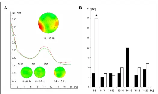 Figure 3.9: Electrophysiological data of different frequency bands. (A) Significant differences in pre-stimulus power between conditions were only found in the upper alpha band (11 to 13 Hz) over left temporal electrodes (e.g