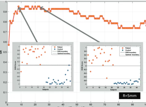 FIG 1. Classiﬁcation results for patients with R-mTLE and healthy controls via leave-one-out cross-validation