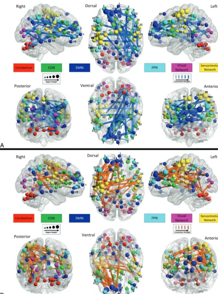 FIG 3. Region weights and connection strengths categorized by hemisphere. The connections are displayed in a surface rendering of a humanbrain