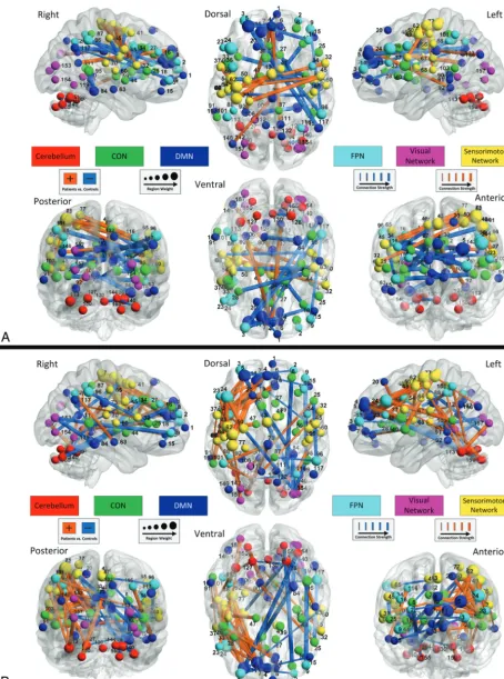 FIG 4. Region weights and connection strengths viewed from inter- and intranetwork perspectives