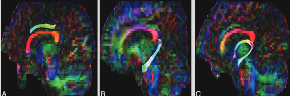 FIG 3. A, Central segment of cingulate gyrus. B, hippocampal segment of cingulate gyrus