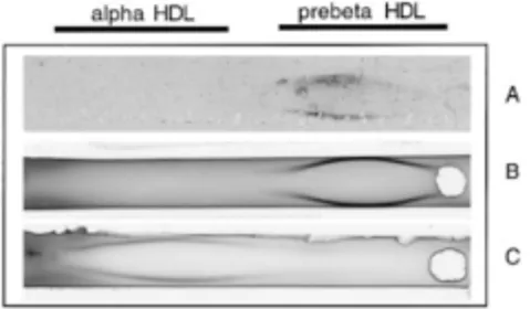 Figure 3.5 Immunoelectrophoretogram. A: Tritiated prebeta-1 HDL  tracer.  B:  Cold  prebeta-1  HDL  prior  to  tritiation