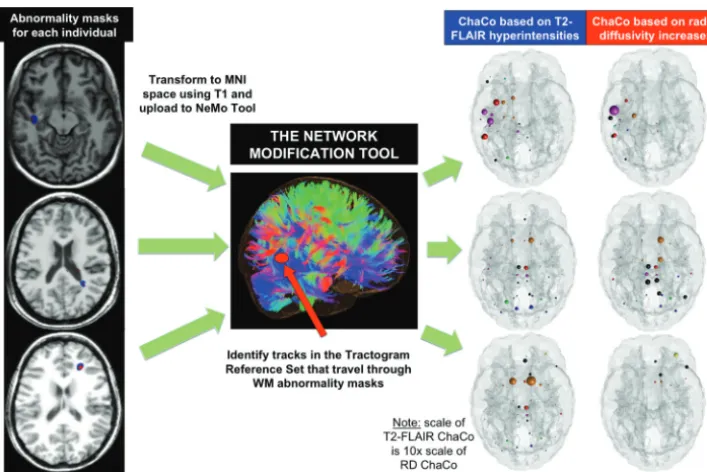 FIG 1. The workﬂow for the NeMo Tool and some examples. T2 FLAIR lesion (blue) and RD abnormality masks (red) were created and normalizedmasks for 3 particular individuals via the glass brain display (denotes functional membership (blue indicates visual; m