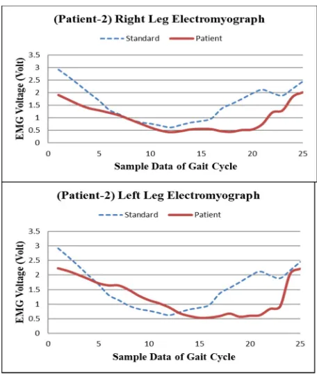 Fig. 6. TABLE I.  EMG data extraction on GBS patient (Right Leg)  
