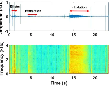 Figure 2.6. Example of a typical Diskus DPI INCA recording audio time domain signal (linear representation of sound pressure) and corresponding spectrogram