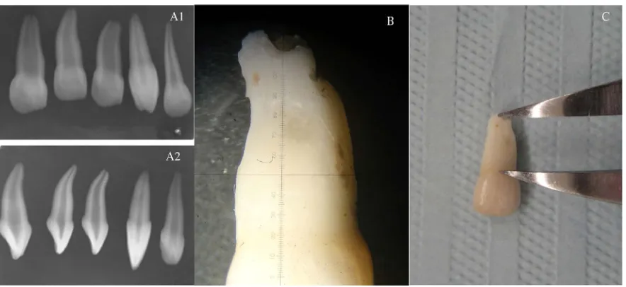 Figure 1. Evaluated tooth sample showing no signs of internal root canal anatomy alterations and no previous root canal manipulation: (A) periapical images showing the internal root canal morphology; (A1) buccal radiographic view; (A2) mesio-distal radiogr