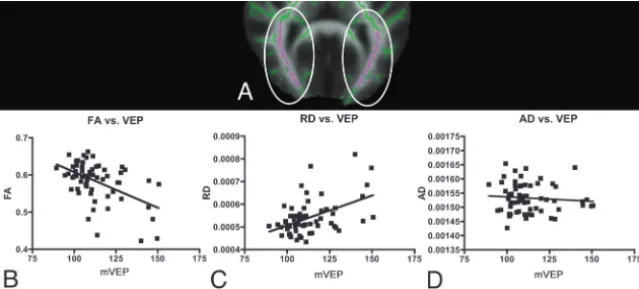 FIG 2. Correlations among mean FA, RD, and AD with mVEP in the optic radiation.signiﬁcant positive correlation of the mean VEP with the mean RD measured in the ROIs isshown (Spearmanderived from the ROIs and the mean VEP is shown (Spearmanmanually selected