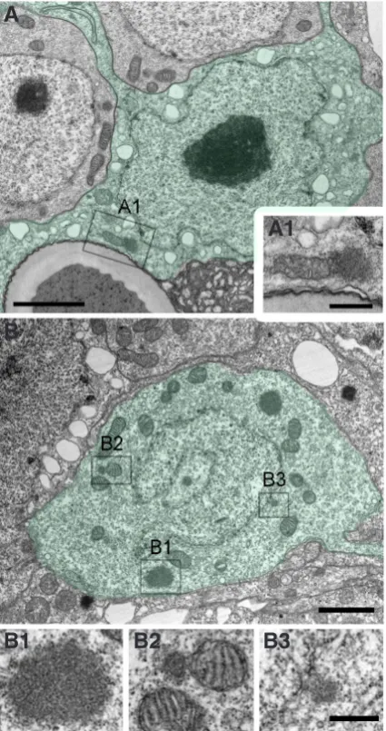 Fig. 3. Electron microscopic visualisation of nuage in Hydra. (A) Part of an ectodermal epitheliomuscular cell (shown in green) including the nucleus and a mitochondrium-associated nuage (A1)