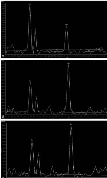 FIG 2. Proton MR spectrum of the pons in subjects of different ages.and a lower Cho level in the 5-year-old child compared with the baby
