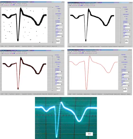 Figure 4. An example for application of the software. (a) Shows a gray image of scanning from a paper; (b) Shows image after digital image processing; (c) Shows red waveform of data sequences; (d) Shows red waveform of needed data sequences; (e) Shows sign
