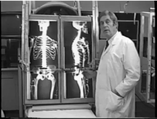 Figure 3Dr. Robert Goddard demonstrating AP and Lateral full body X-rays.