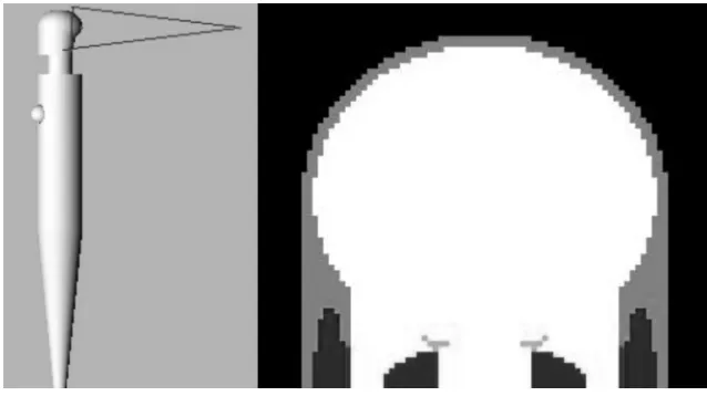 FIG 1. Anthropomorphic phantom used for brain-dose calculation. On the left, a posterior beamprojection on the phantom head is shown