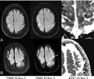 Figure 4 depicts 2 cases in which echo
