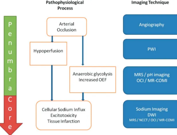 FIG 1. Approach to metabolic imaging of acute stroke. On the left, the tissue compartments(penumbra/core) are delineated