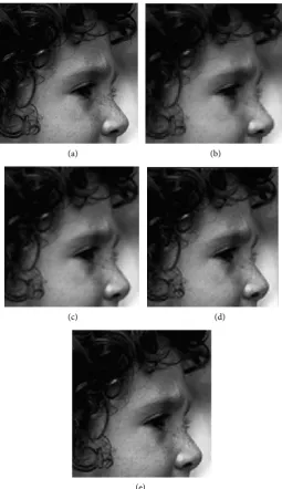Figure 4. Super-resolution reconstruction result of Head under different methods. 