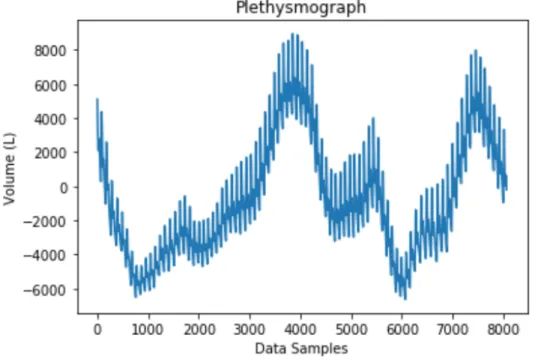 Figure 6. Plethysmograph readings over 63 seconds of participant number 6. 