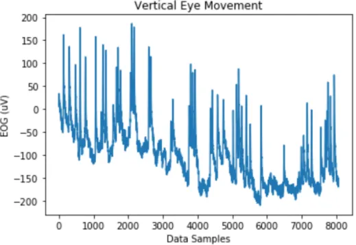 Figure 8. Vertical eye movement readings over 63 seconds of participant number 6. 