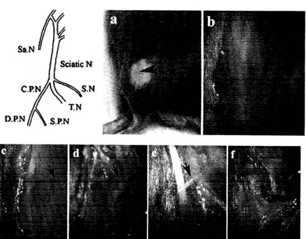 Figure  12.  Diagram  illustrating  the  ligation  of  the  CPN  in  mouse 
