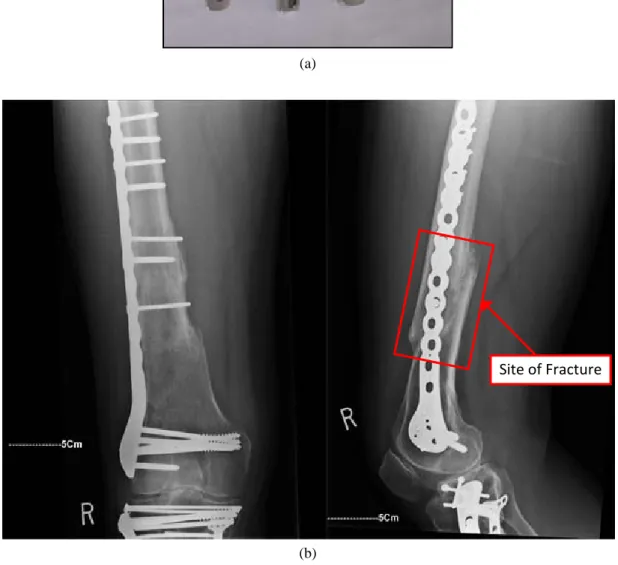 Figure 4.2.7 Buttress plate: (a) buttress plate side view [57], (b) Buttress plate plan view [58] 