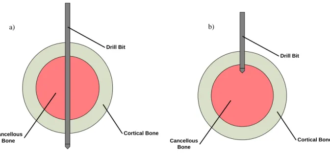 Figure 4-1: The orthopaedic drill penetrating a cross-section of a bone a) bi-cortically, and b) unicortically