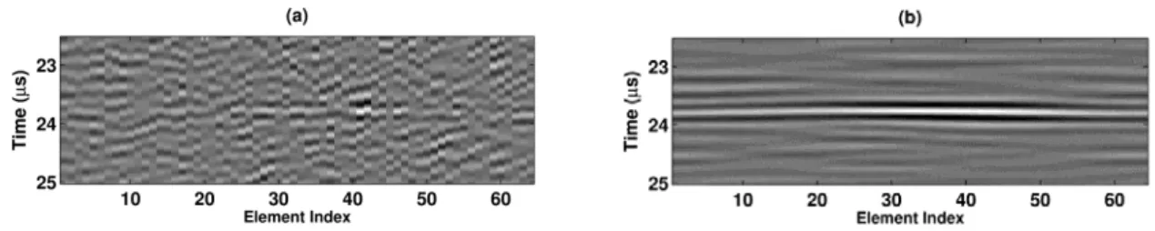 Figure 4-4. Aligned channel RF signals in simulation (a) without and (b) with 2-D aperture domain filter from a  speckle generating phantom