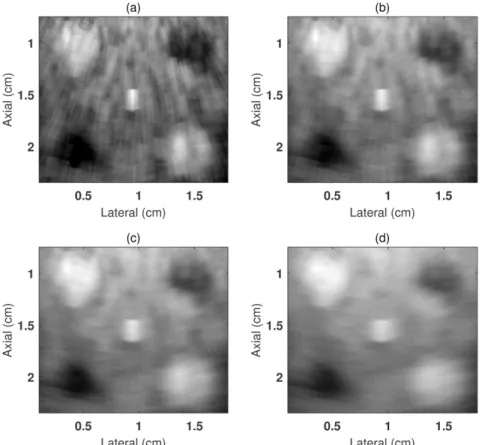 Figure 5-2. Beamformed images of the tissue mimicking phantom (Figure 4-9) reconstructed using FFC with  different Hanning window filter sizes as: (a) 1.6, (b) 2.6, (c) 3.6, (d) 5.2 cm -1 