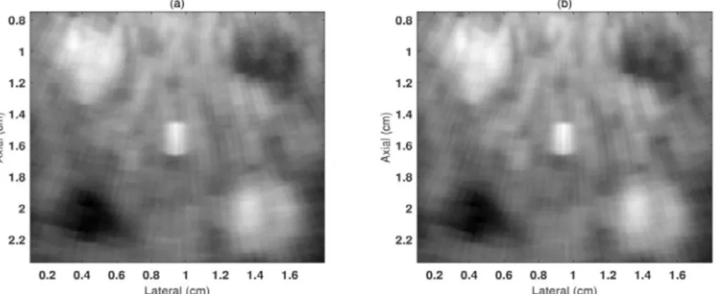 Figure 5-10. Beamformed images of tissue mimicking phantom obtained with FFC with (a) and without (b)  normalization