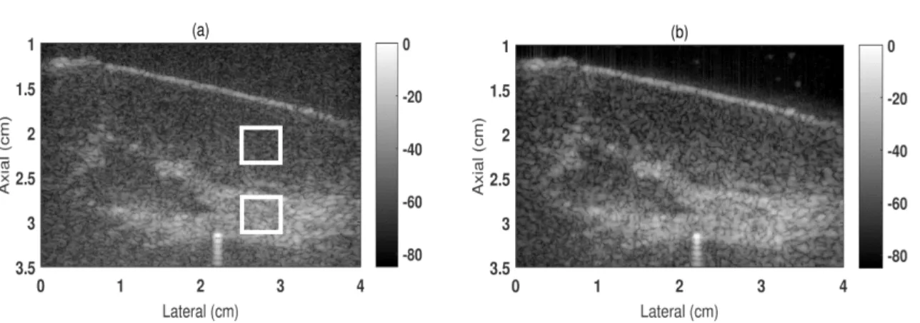 Figure 6-1 shows a preliminary test of the TPI-DE-STA technique on a porcine  kidney and Table 6-1 shows the image metric values