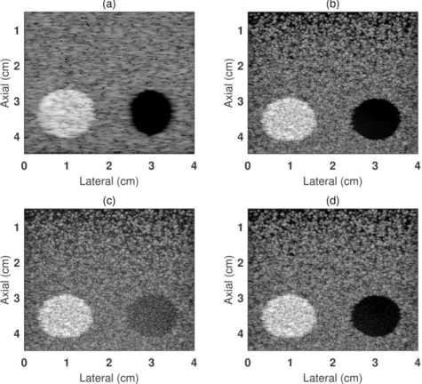 Figure 2-5. Simulated log-enveloped beamformed images obtained in (a) B-mode imaging, (b) traditional STA  imaging without adding noise, (c) traditional STA imaging with noise and (d) DE-STA imaging with the same 