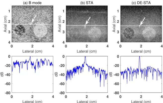 Figure 2-6. Experimental log-enveloped beamformed images obtained in (a) B-mode imaging, (b) traditional  STA imaging and (c) DE-STA imaging