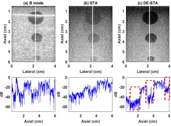 Figure 2-7. Experimental log-enveloped beamformed images obtained in (a) B-mode imaging, (b) traditional  STA imaging and (c) DE-STA imaging