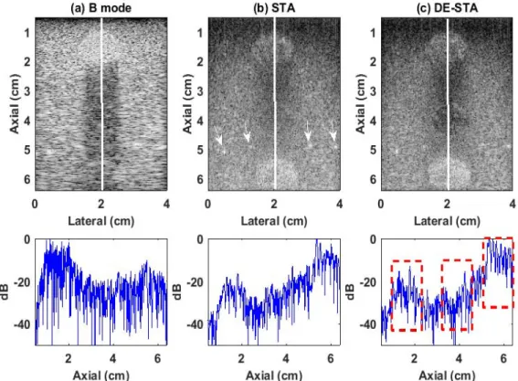 Figure 2-8. Experimental log-enveloped beamformed images obtained in (a) B-mode imaging, (b) traditional  STA imaging and (c) DE-STA imaging